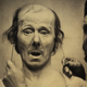 Illustration for article titled Terrifying, Century-Old Photographs from Neuroscience Experiments